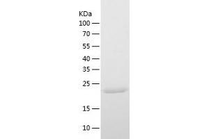 Proteasome Subunit alpha 5 (PSMA5) (AA 1-241) protein (His-IF2DI Tag)