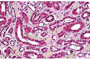 Human Kidney, Tubules: Formalin-Fixed, Paraffin-Embedded (FFPE) (ACP2 抗体  (AA 1-424))