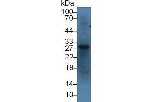 Detection of IGFBP1 in Bovine Liver lysate using Polyclonal Antibody to Insulin Like Growth Factor Binding Protein 1 (IGFBP1) (IGFBPI 抗体  (AA 112-263))
