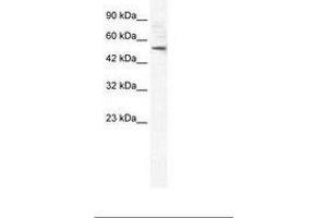 Image no. 2 for anti-Sphingomyelin phosphodiesterase, Acid-Like 3B (SMPDL3B) (AA 88-137) antibody (ABIN6735957) (SMPDL3B 抗体  (AA 88-137))