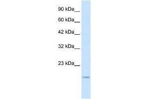 Western Blot showing SNAI1 antibody used at a concentration of 0.