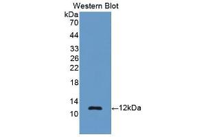 Western blot analysis of the recombinant protein. (Renin 抗体  (AA 144-237))