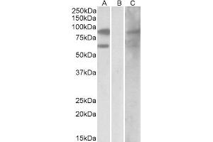 HEK293 lysate (10ug protein in RIPA buffer) overexpressing Human RACGAP1 with DYKDDDDK tag probed with ABIN2564849 (0. (RACGAP1 抗体  (C-Term))