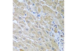 Immunohistochemistry of paraffin-embedded human liver using WDR48 antibody (ABIN5974731) at dilution of 1/100 (40x lens). (WDR48 抗体)