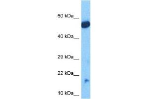 Western Blotting (WB) image for anti-NADH Dehydrogenase (Ubiquinone) 1 beta Subcomplex, 11, 17.3kDa (NDUFB11) (C-Term) antibody (ABIN5517202)