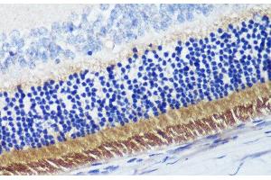 Immunohistochemistry of paraffin-embedded Rat retina using PDE6B Polyclonal Antibody at dilution of 1:200 (40x lens). (PDE6B 抗体)