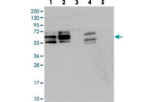Western blot analysis of Lane 1: RT-4, Lane 2: U-251 MG, Lane 3: Human Plasma, Lane 4: Liver, Lane 5: Tonsil with BICC1 polyclonal antibody  at 1:250-1:500 dilution. (BICC1 抗体)