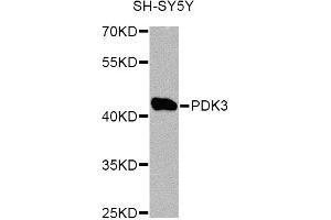 Western blot analysis of extracts of SH-SY5Y cells, using PDK3 Antibody. (PDK3 抗体)