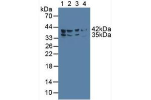 Western blot analysis of (1) Human HepG2 Cells, (2) Porcine Liver Tissue, (3) Porcine Large IntestineTissue and (4) Rat Pancreas Tissue. (FADS2 抗体  (AA 1-130))