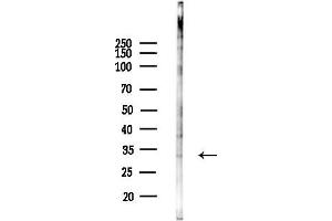 Western blot analysis of lysates from COLO205 cells, using SLC39 Antibody at 1/1000 dilution.
