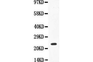 Anti-IL18 Picoband antibody,  All lanes: Anti-IL18 at 0. (IL-18 抗体  (AA 37-193))