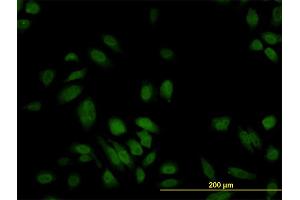 Immunofluorescence of monoclonal antibody to S100A6 on HeLa cell. (S100A6 抗体  (AA 1-90))