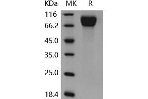Western Blotting (WB) image for Colony Stimulating Factor 1 Receptor (CSF1R) (Active) protein (His tag) (ABIN7320415)