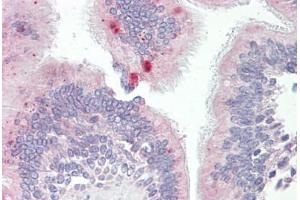 Anti-AP3M1 antibody IHC staining of human lung, respiratory epithelium. (AP3M1 抗体  (AA 140-190))