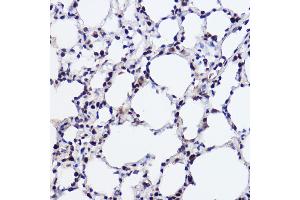 Immunohistochemistry of paraffin-embedded rat lung using GTF2I Rabbit mAb (ABIN1682306, ABIN3015201, ABIN3015202 and ABIN7101319) at dilution of 1:100 (40x lens). (GTF2I 抗体)