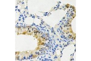 Immunohistochemical analysis of PPX staining in rat lung formalin fixed paraffin embedded tissue section. (PPP4C 抗体)