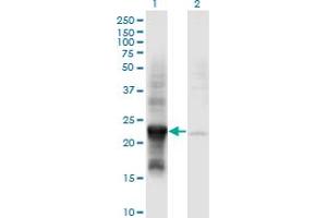 Western Blot analysis of COX4NB expression in transfected 293T cell line by COX4NB monoclonal antibody (M01), clone 4F4. (COX4NB 抗体  (AA 113-210))