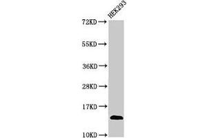 Western Blot Positive WB detected in: HEK293 whole cell lysate All lanes: TRBV7-9 antibody at 3 μg/mL Secondary Goat polyclonal to rabbit IgG at 1/50000 dilution Predicted band size: 14 kDa Observed band size: 14 kDa (TCRb 抗体  (AA 22-115))