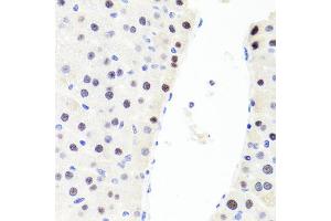 Immunohistochemistry of paraffin-embedded rat liver using RUNX1 antibody (ABIN6291786) at dilution of 1:100 (40x lens).