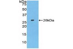 Detection of Recombinant AXIN, Human using Polyclonal Antibody to Axis Inhibition Protein (AXIN) (Axin 抗体  (AA 653-862))