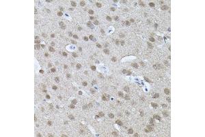 Immunohistochemistry of paraffin-embedded mouse brain using RNF166 antibody (ABIN5974659) (40x lens). (RNF166 抗体)