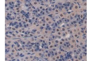 Immunohistochemistry (IHC) image for anti-Glutamate-Cysteine Ligase, Catalytic Subunit (GCLC) (AA 435-636) antibody (ABIN1858972)