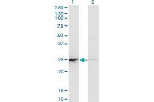 Western Blot analysis of PSMD10 expression in transfected 293T cell line by PSMD10 monoclonal antibody (M19), clone 3F10. (PSMD10 抗体  (AA 1-226))
