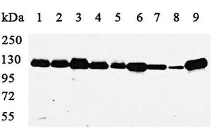 Western blot analysis using PARP1 antibody against MCF(1), A549(2), HepG2(3), COS7(4),C2C12(5),A431(6),MDCK(7),PC12(8) and Jurkat cell lysate(9). (PARP1 抗体)