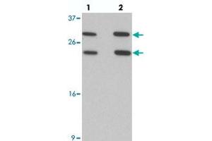 Western blot analysis of MS4A6A in 293 cell lysate with MS4A6A polyclonal antibody  at (lane 1) 1 and (lane 2) 2 ug/mL. (MS4A6A 抗体  (N-Term))