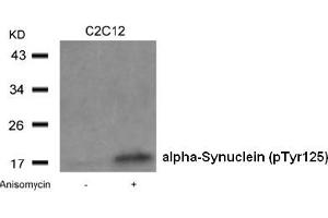 Image no. 2 for anti-Synuclein, alpha (SNCA) (pTyr125) antibody (ABIN401546) (SNCA 抗体  (pTyr125))