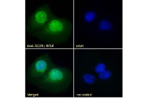 ABIN185043 Immunofluorescence analysis of paraformaldehyde fixed U2OS cells, permeabilized with 0. (BCOR 抗体  (N-Term))