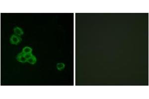Immunofluorescence analysis of MCF7 cells, using CaMK2 alpha/delta (Ab-286) Antibody. (CaMK2 alpha/delta 抗体  (AA 256-305))
