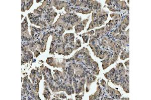 IHC analysis of hnRNP L/HNRNPL using anti-hnRNP L/HNRNPL antibody (ABIN7600130).