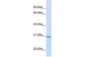 DCI antibody used at 1 ug/ml to detect target protein. (DCI 抗体)