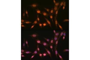 Immunofluorescence (IF) image for anti-Protein Arginine Methyltransferase 1 (PRMT1) antibody (ABIN7269604)