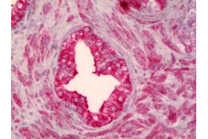 Anti-SMO antibody IHC of human prostate. (SMO 抗体)