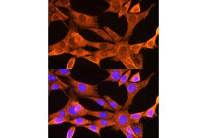 Immunofluorescence (IF) image for anti-Voltage-Dependent Anion Channel 2 (VDAC2) (AA 1-100) antibody (ABIN7271337)