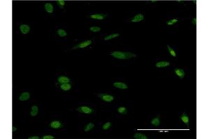 Immunofluorescence of monoclonal antibody to HCLS1 on HeLa cell. (HCLS1 抗体  (AA 266-355))