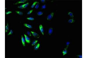 Immunofluorescent analysis of Hela cells using ABIN7153327 at dilution of 1:100 and Alexa Fluor 488-congugated AffiniPure Goat Anti-Rabbit IgG(H+L) (GPR161 抗体  (AA 1-28))