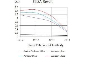 Black line: Control Antigen (100 ng),Purple line: Antigen (10 ng), Blue line: Antigen (50 ng), Red line:Antigen (100 ng) (Macrophage Scavenger Receptor 1 抗体  (AA 275-451))