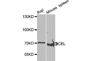 Western blot analysis of extracts of various cell lines, using CEL antibody (ABIN5975616) at 1/1000 dilution. (Cholesterol Esterase 抗体)