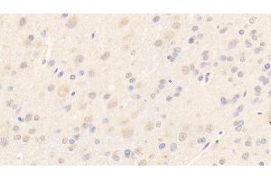 Immunohistochemistry (IHC) image for anti-Laminin, beta 2 (Laminin S) (LAMB2) (AA 939-1129) antibody (ABIN7444094)