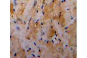 Used in DAB staining on fromalin fixed paraffin-embedded Heart tissue (Galectin 3 抗体  (AA 1-250))