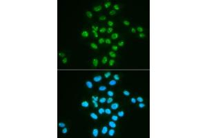 Immunofluorescence analysis of HeLa cells using Bmi1 antibody (ABIN6130877, ABIN6137590, ABIN6137592 and ABIN6217484). (BMI1 抗体  (AA 120-326))