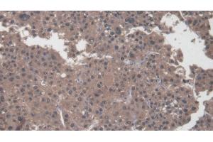 Immunohistochemistry (IHC) image for anti-Collagen, Type I, alpha 2 (COL1A2) (AA 1103-1366) antibody (ABIN7431329)