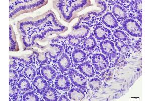 Immunohistochemistry (Paraffin-embedded Sections) (IHC (p)) image for anti-Nuclear Receptor Subfamily 1, Group I, Member 2 (NR1I2) (AA 51-150) antibody (ABIN679598)