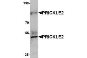Western blot analysis of PRICKLE2 in A-20 lysate with PRICKLE2 antibody at 1 μg/mL. (PRICKLE2 抗体  (Middle Region))