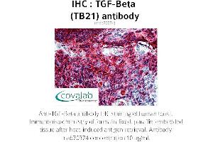 Image no. 2 for anti-TGF-beta (TGFb) antibody (ABIN1723276) (TGF-beta 抗体)