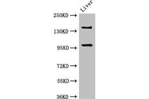 Western Blot Positive WB detected in: Mouse liver tissue All lanes: PHLDB2 antibody at 3 μg/mL Secondary Goat polyclonal to rabbit IgG at 1/50000 dilution Predicted band size: 143, 137, 140 kDa Observed band size: 143, 96 kDa (PHLDB2 抗体  (AA 734-1030))