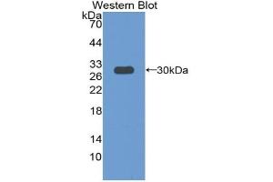 Detection of Recombinant PXN, Mouse using Polyclonal Antibody to Paxillin (PXN) (Paxillin 抗体  (AA 347-578))